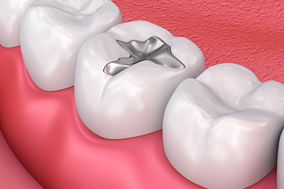 Just Smile  Dental Center