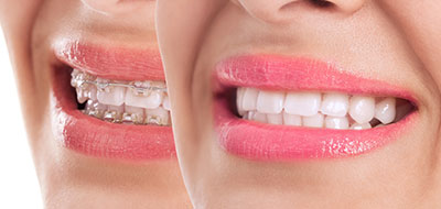 Just Smile  Dental Center