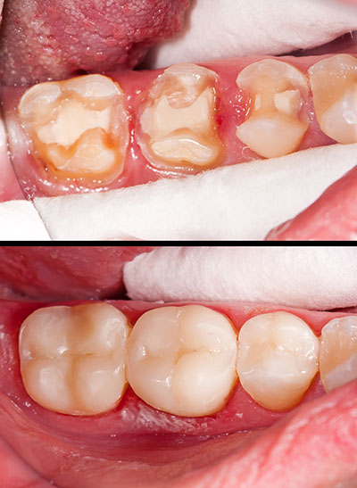 Just Smile  Dental Center