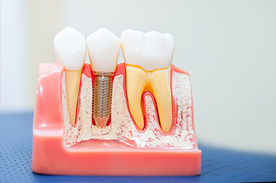 Just Smile  Dental Center