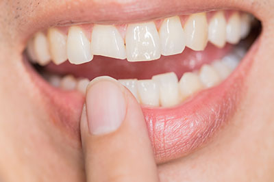 Just Smile  Dental Center