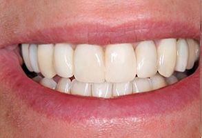 Just Smile  Dental Center