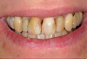 Just Smile  Dental Center